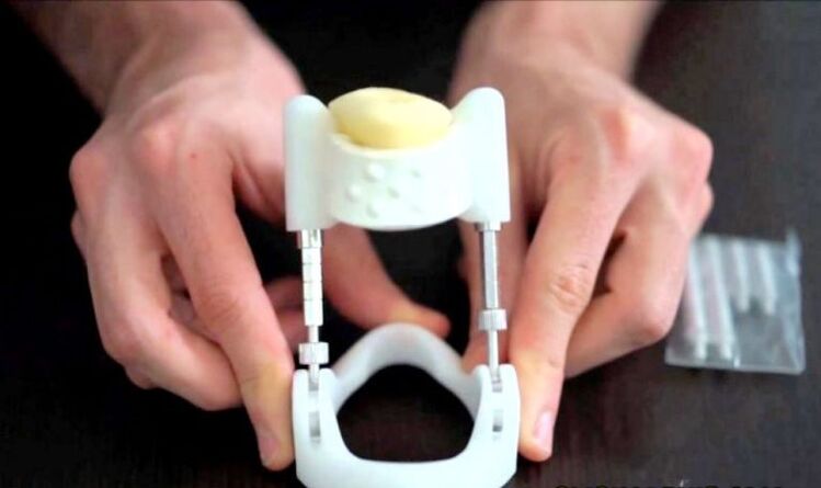 Extensor para a ampliación do pene